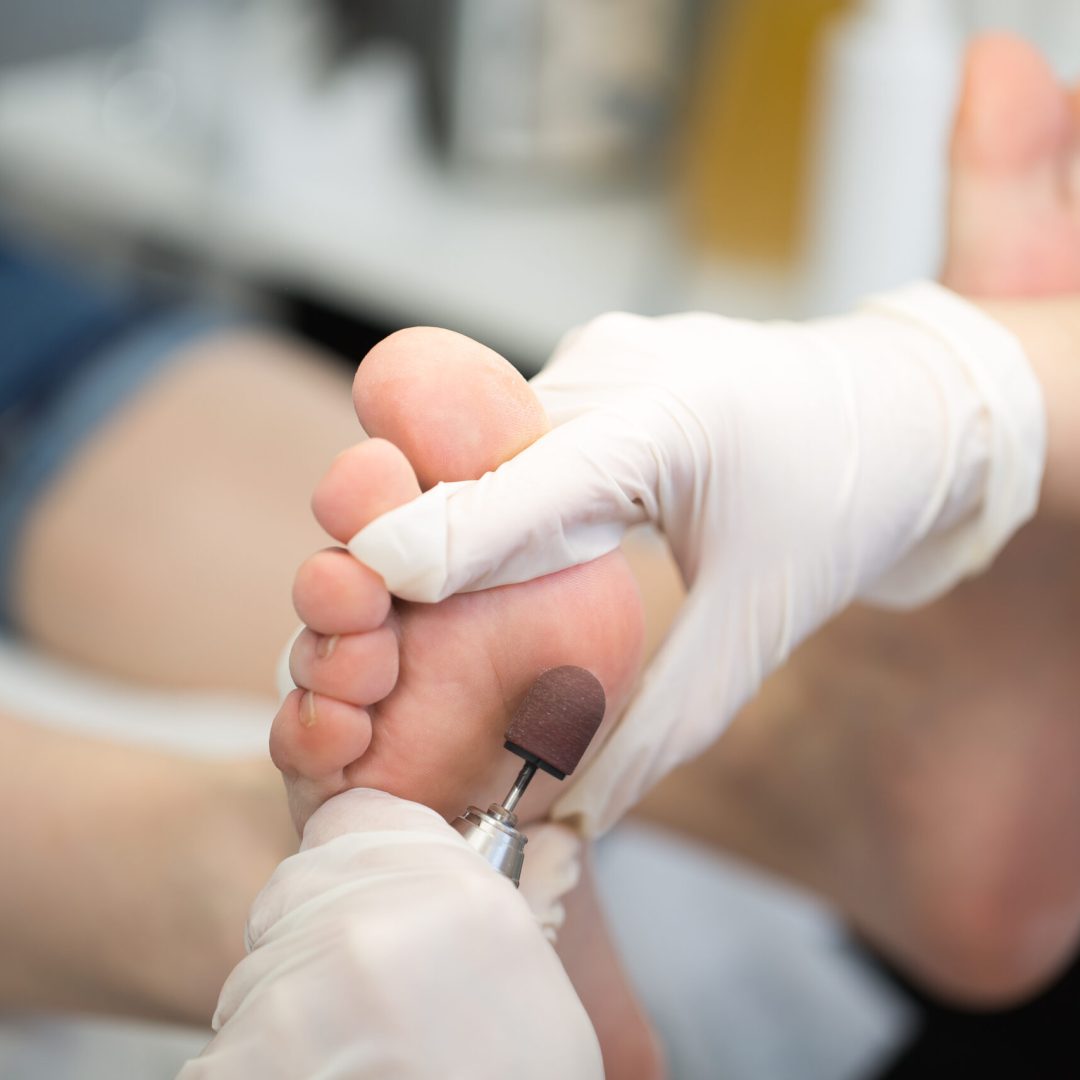 Process pedicure close-up, polishing feet